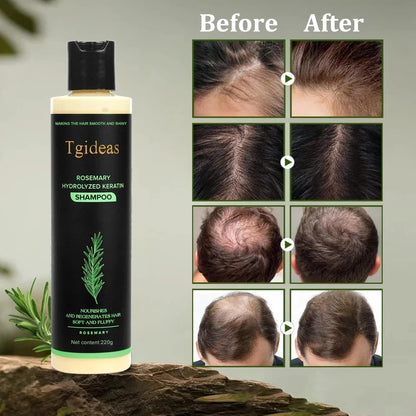 Tgideas Organic Rosemary Hair Growth Shampoo for Women and Men-Natural