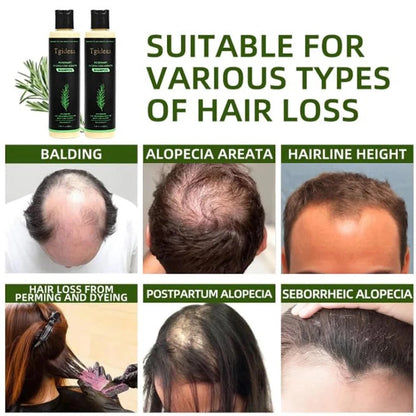 Tgideas Organic Rosemary Hair Growth Shampoo for Women and Men-Natural